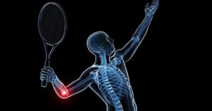 tennis elbow