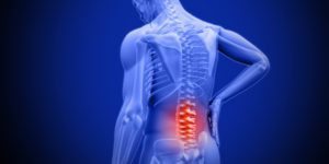alleviating low back pain