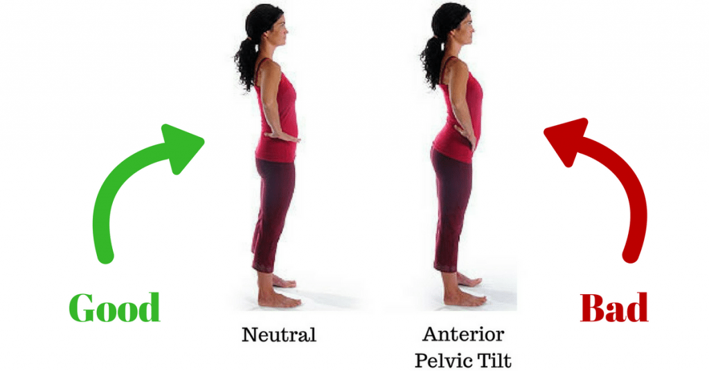 Anterior Pelvic Tilt: What It Is & How To Fix It. - Complete Fitness Design