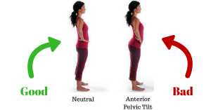anterior pelvic tilt